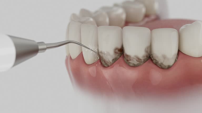 Reliable Dental Implants contractor in Cheviot, OH by Smile Center Dentistry